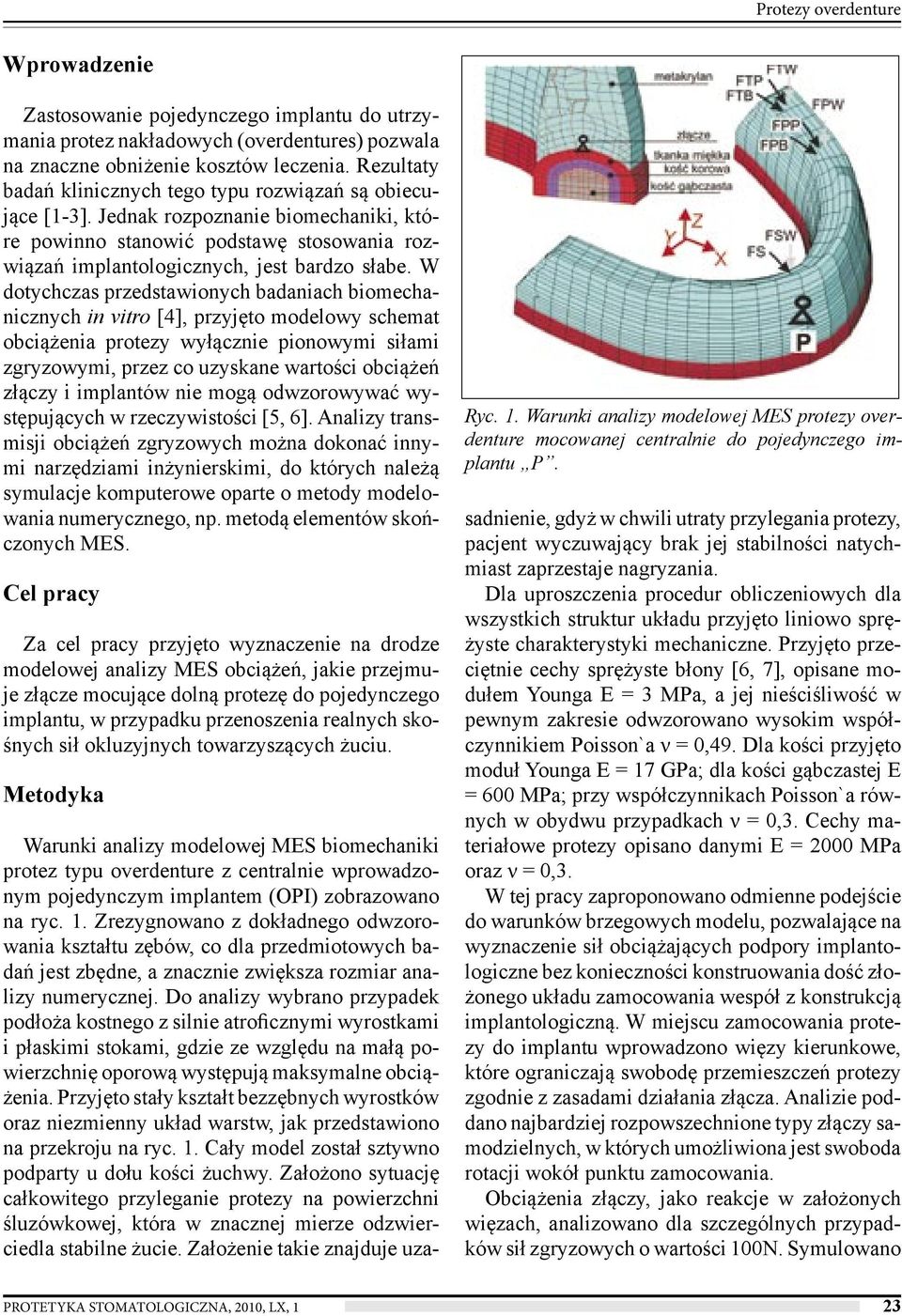 W dotychczas przedstawionych badaniach biomechanicznych in vitro [4], przyjęto modelowy schemat obciążenia protezy wyłącznie pionowymi siłami zgryzowymi, przez co uzyskane wartości obciążeń złączy i