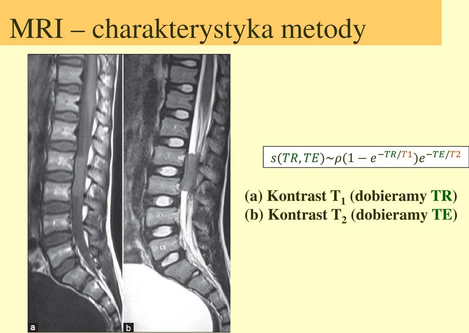 (a) Kontrast T 1 (dobieramy