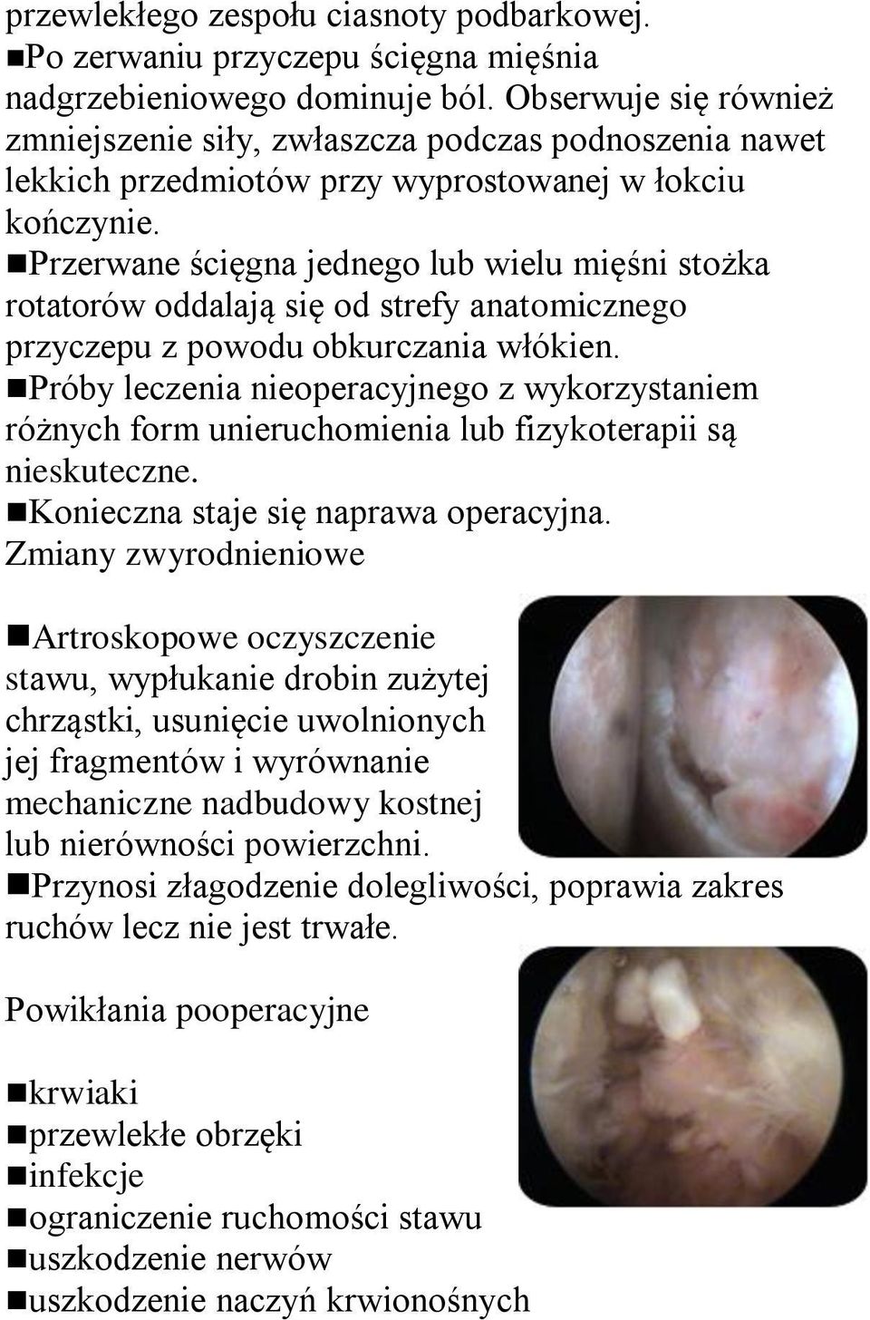 Przerwane ścięgna jednego lub wielu mięśni stożka rotatorów oddalają się od strefy anatomicznego przyczepu z powodu obkurczania włókien.