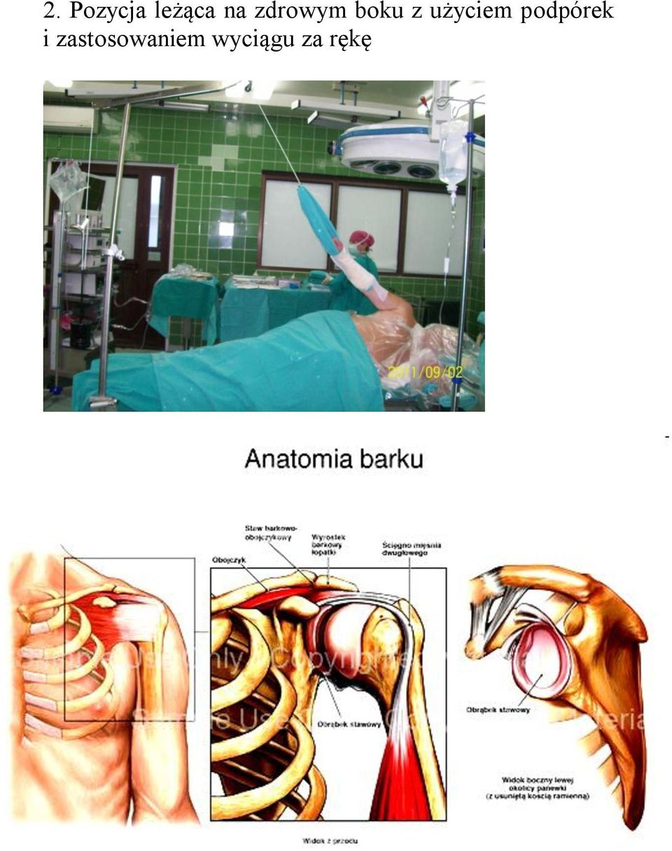 użyciem podpórek i