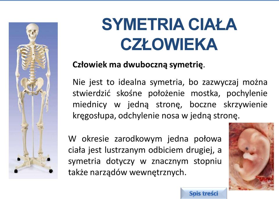 miednicy w jedną stronę, boczne skrzywienie kręgosłupa, odchylenie nosa w jedną stronę.
