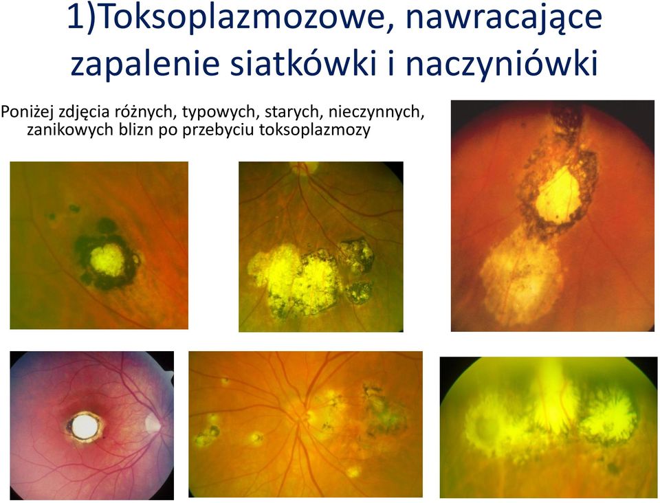 różnych, typowych, starych, nieczynnych,