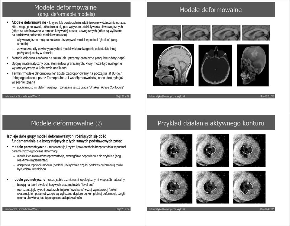 (które są zdefiniowane w ramach krzywych) oraz sił zewnętrznych (które są wyliczane na podstawie położenia modelu w obrazie) siły wewnętrzne mają za zadanie utrzymywać model w postaci gładkiej (ang.