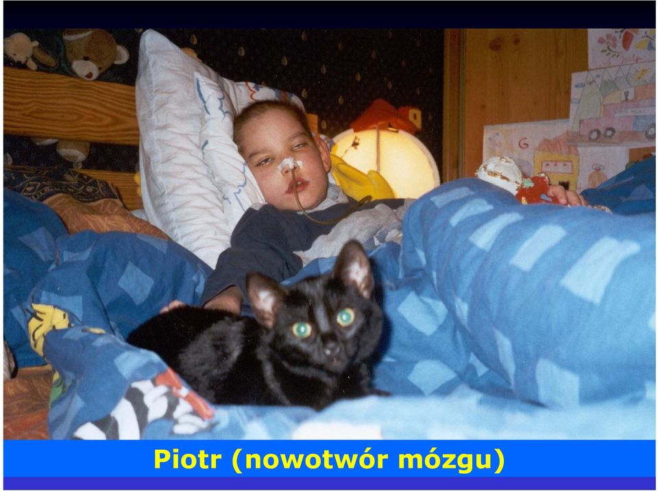 mózgu)