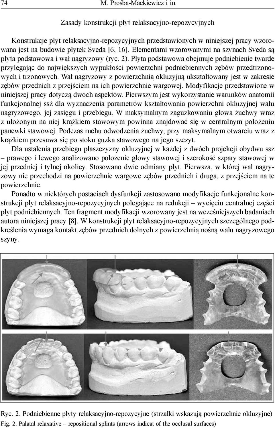 Elementami wzorowanymi na szynach Sveda są płyta podstawowa i wał nagryzowy (ryc. 2).