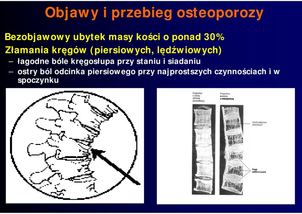 łagodne bóle kręgosłupa przy staniu i siadaniu ostry ból