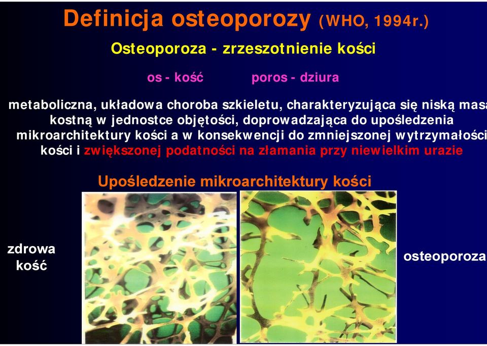 charakteryzująca się niską masą kostną w jednostce objętości, doprowadzająca do upośledzenia