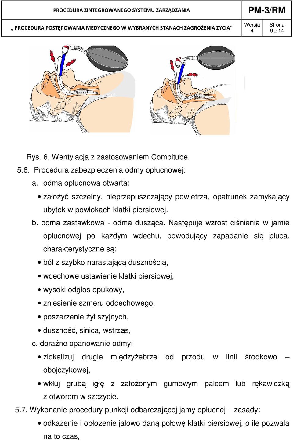 Następuje wzrost ciśnienia w jamie opłucnowej po każdym wdechu, powodujący zapadanie się płuca.