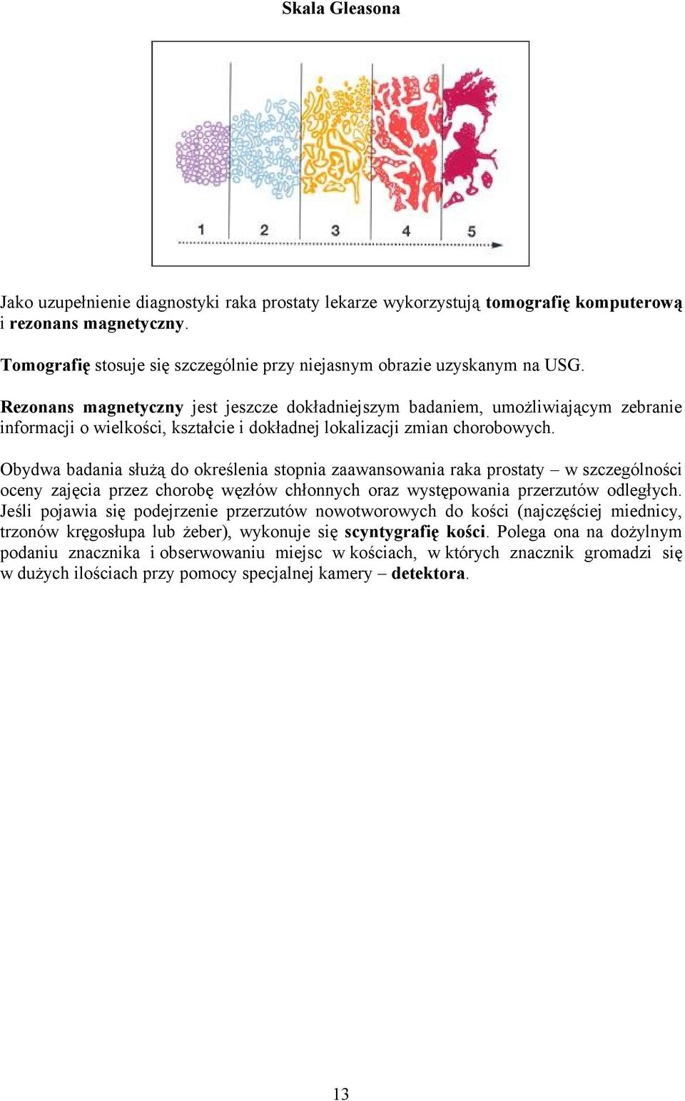 Rezonans magnetyczny jest jeszcze dokładniejszym badaniem, umożliwiającym zebranie informacji o wielkości, kształcie i dokładnej lokalizacji zmian chorobowych.