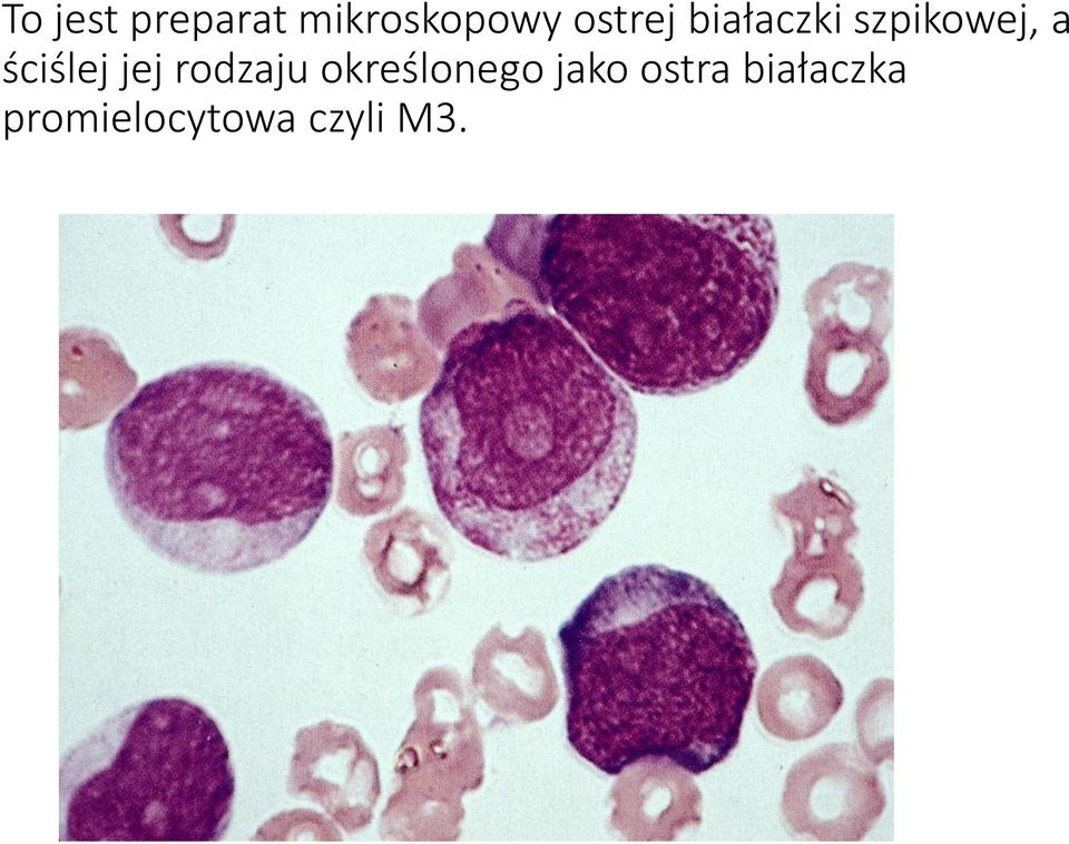 ściślej jej rodzaju określonego