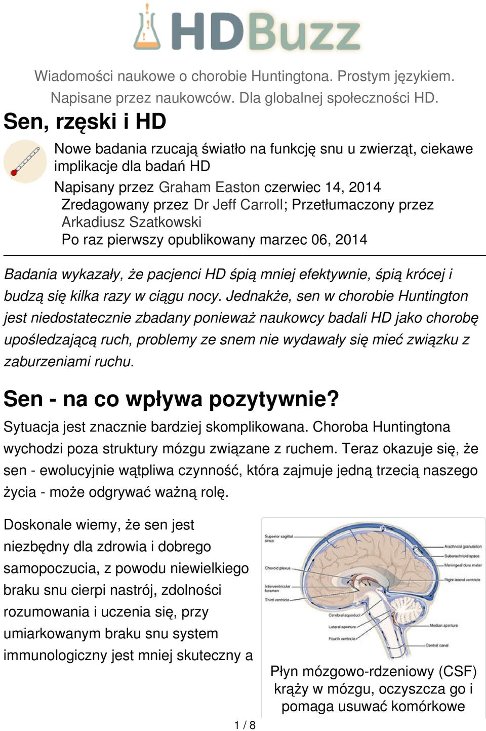 Przetłumaczony przez Arkadiusz Szatkowski Po raz pierwszy opublikowany marzec 06, 2014 Badania wykazały, że pacjenci HD śpią mniej efektywnie, śpią krócej i budzą się kilka razy w ciągu nocy.