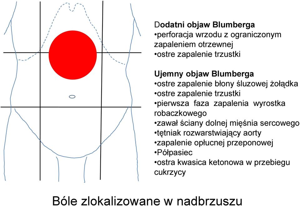 zapalenia wyrostka robaczkowego zawał ściany dolnej mięśnia sercowego tętniak rozwarstwiający aorty