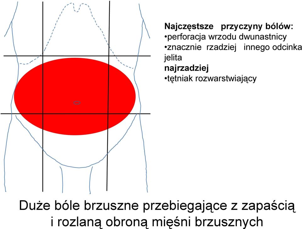 najrzadziej tętniak rozwarstwiający DuŜe bóle