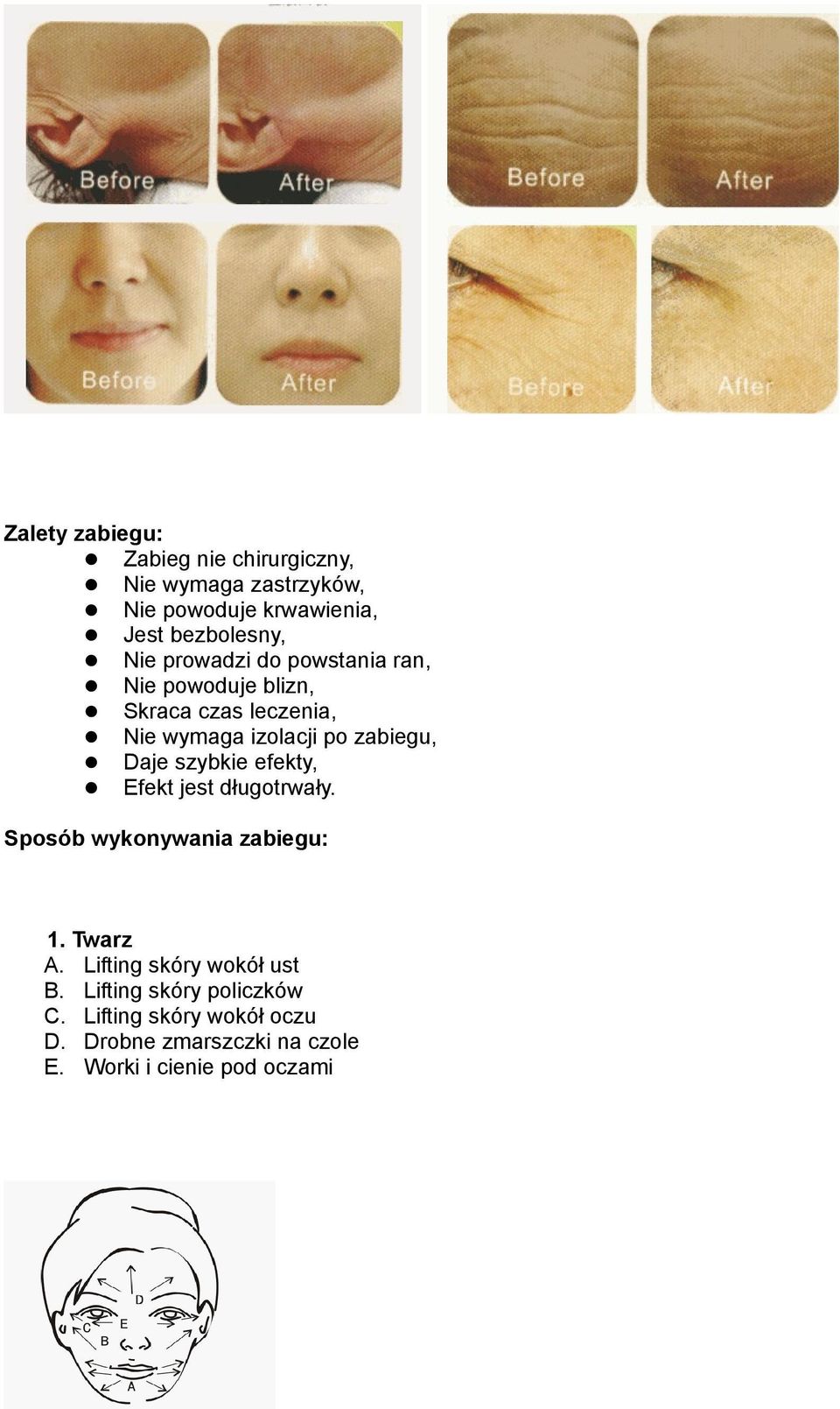 Daje szybkie efekty, Efekt jest długotrwały. Sposób wykonywania zabiegu: 1. Twarz A.