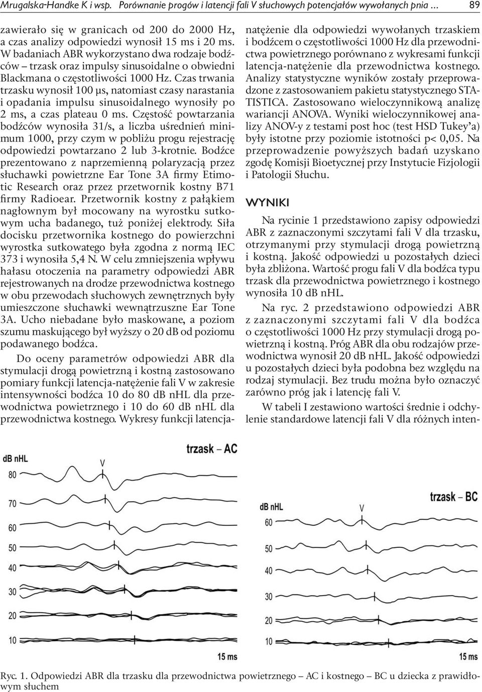 Czas trwania trzasku wynosił 100 μs, natomiast czasy narastania i opadania impulsu sinusoidalnego wynosiły po 2 ms, a czas plateau 0 ms.