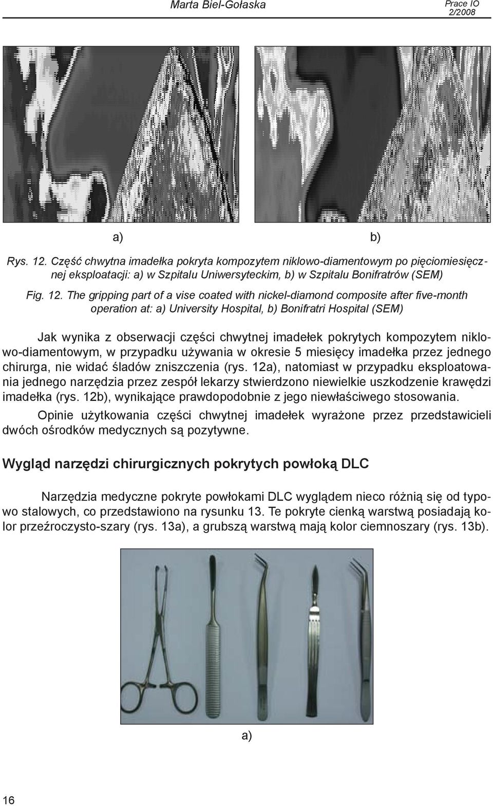 The gripping part of a vise coated with nickel-diamond composite after five-month operation at: a) University Hospital, b) Bonifratri Hospital (SEM) Jak wynika z obserwacji części chwytnej imadełek