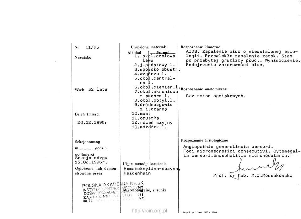 Przewlekłe zapalenie zatok. Stan po przebytej gruźlicy płuc.. Wyniszczenie Podejrzenie zatorowości płuc. * Rozpoznanie anatomiczne Bez zmian ogniskowych.