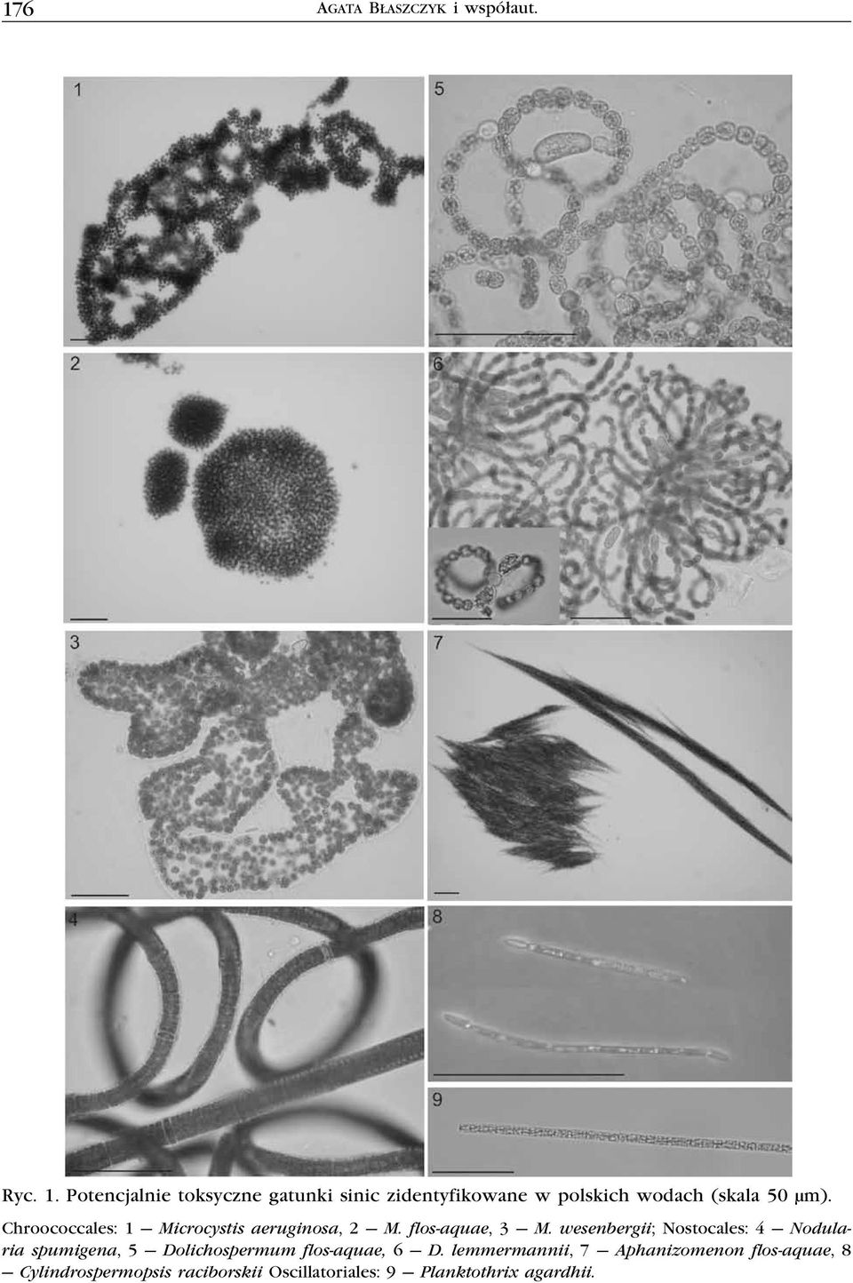 Chroococcales: 1 Microcystis aeruginosa, 2 M. flos-aquae, 3 M.