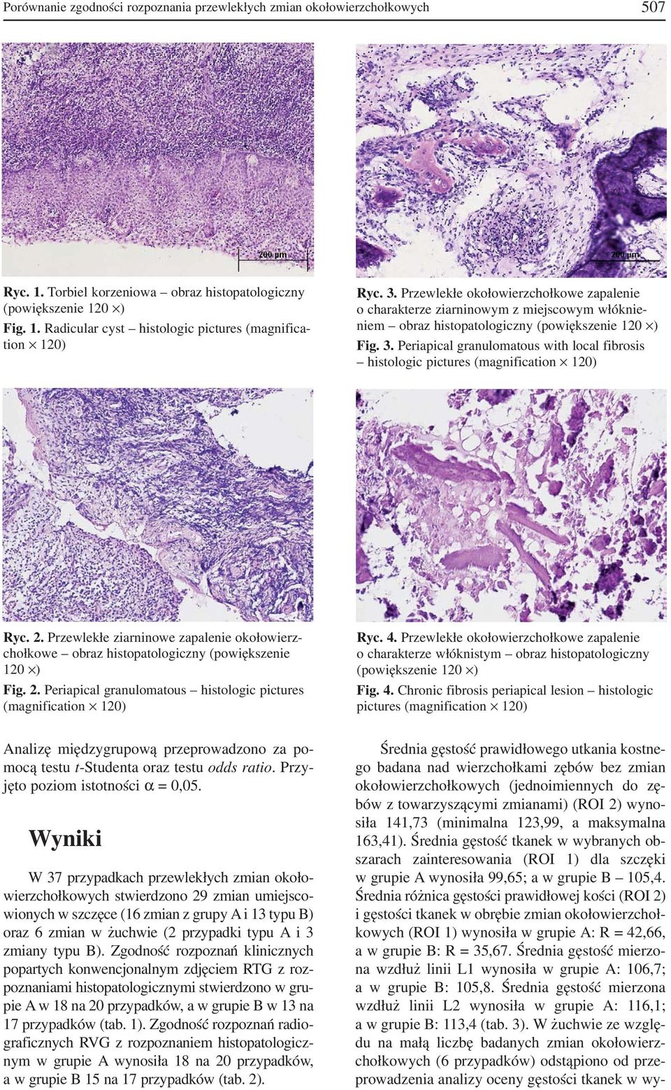 Periapical granulomatous with local fibrosis histologic pictures (magnification 120) Ryc. 2. Przewlekłe ziarninowe zapalenie okołowierz chołkowe obraz histopatologiczny (powiększenie 120 ) Fig. 2. Periapical granulomatous histologic pictures (magnification 120) Ryc.