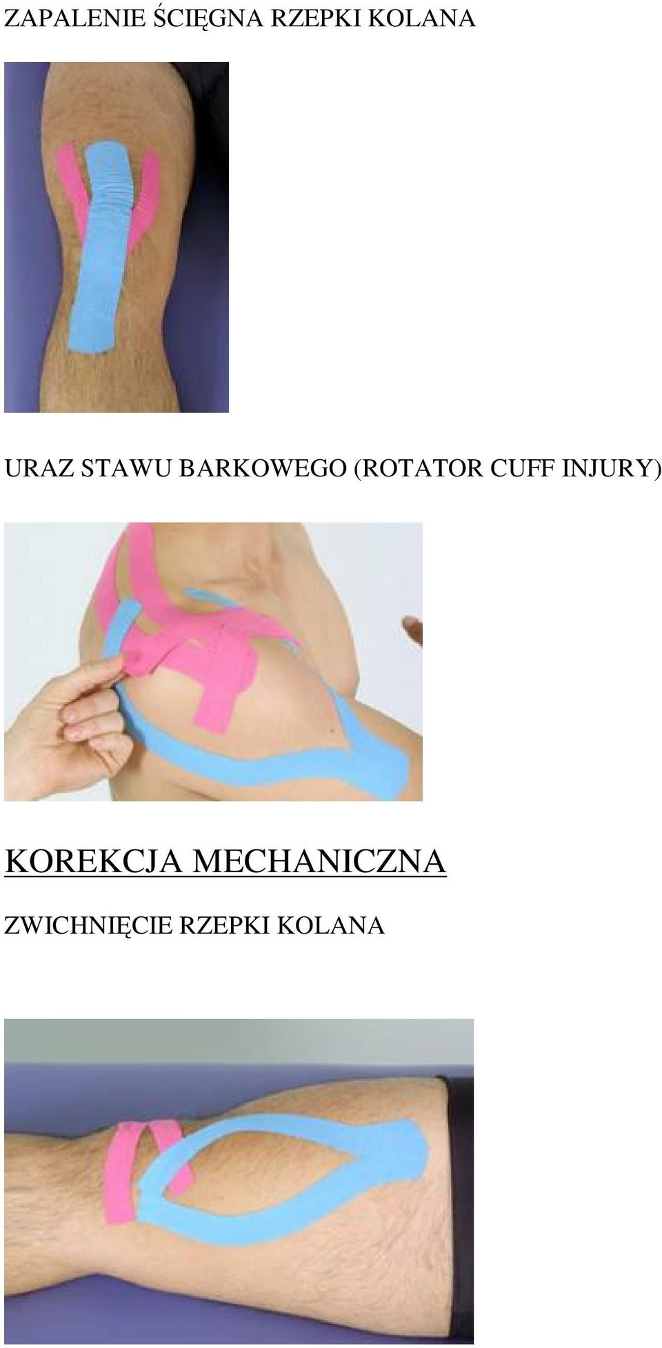 (ROTATOR CUFF INJURY) KOREKCJA