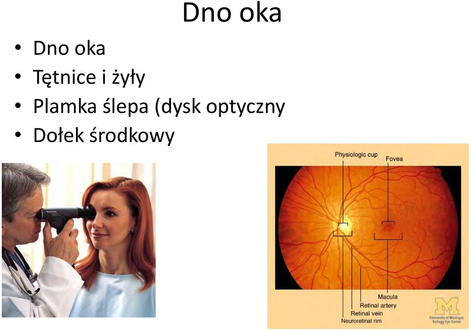 Plamka ślepa (dysk