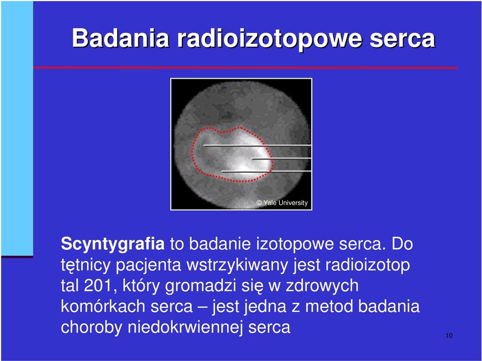 Do ttnicy pacjenta wstrzykiwany jest radioizotop tal 201,