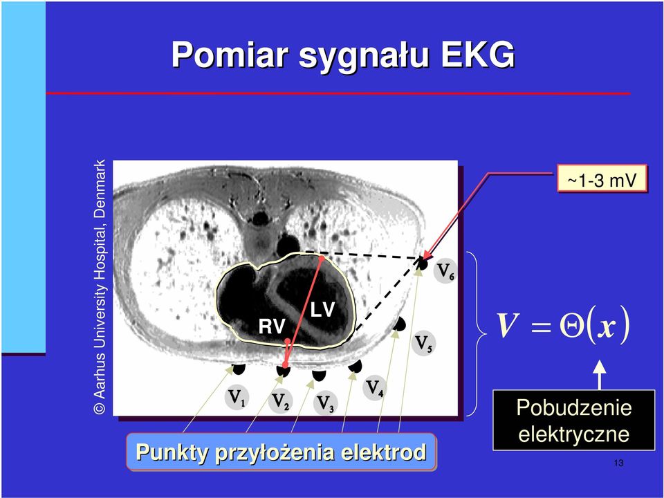 LV Punkty przyłoenia elektrod V