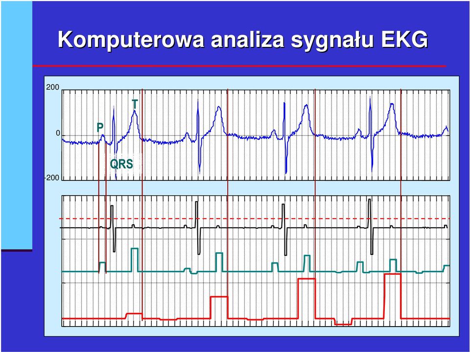 sygnału EKG