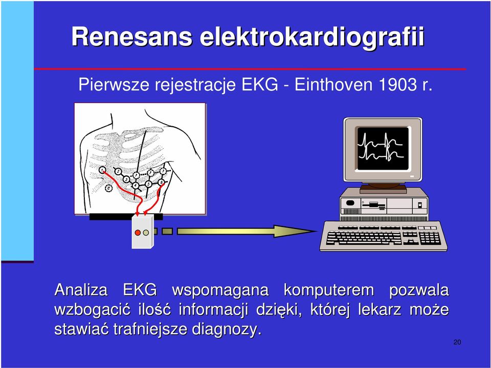 Analiza EKG wspomagana komputerem pozwala