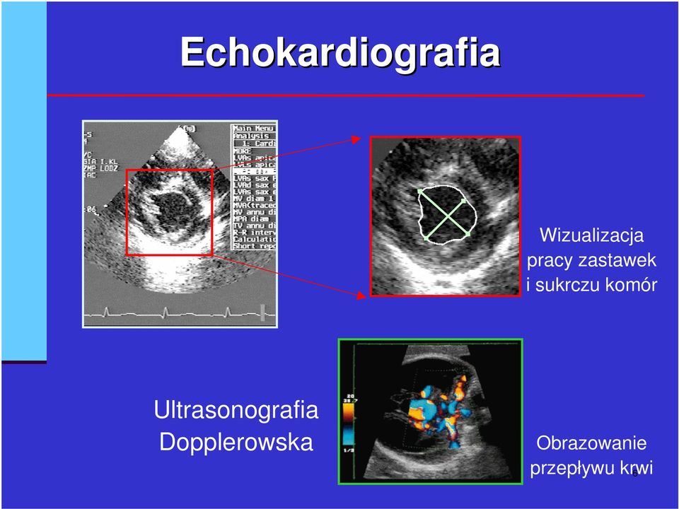 komór Ultrasonografia