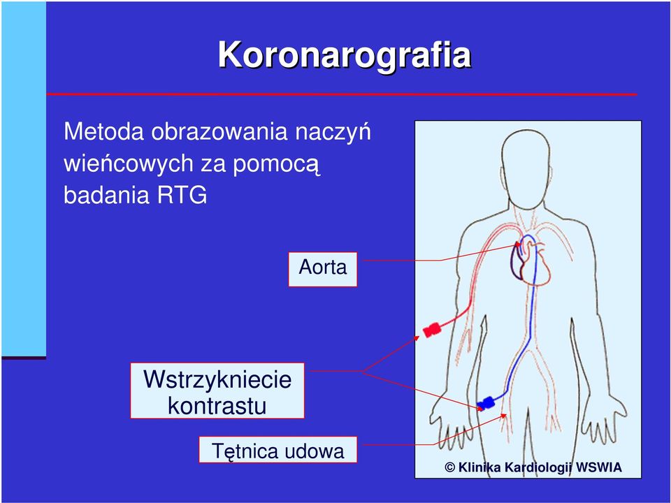 RTG Aorta Wstrzykniecie kontrastu