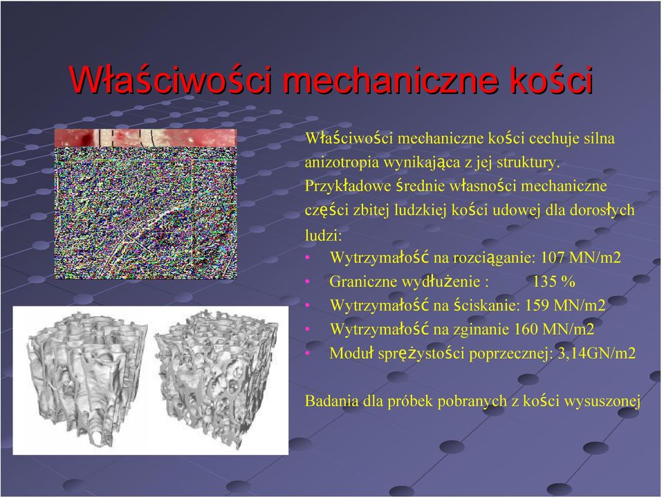 Przykładowe średnie własności mechaniczne części zbitej ludzkiej kości udowej dla dorosłych ludzi: