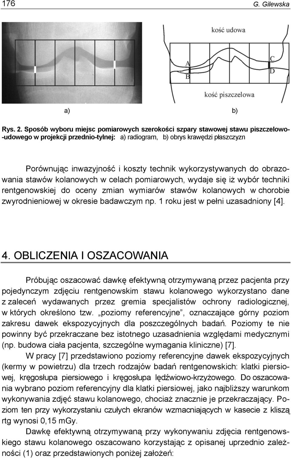 wykorzystywanych do obrazowania stawów kolanowych w celach pomiarowych, wydaje się iż wybór techniki rentgenowskiej do oceny zmian wymiarów stawów kolanowych w chorobie zwyrodnieniowej w okresie