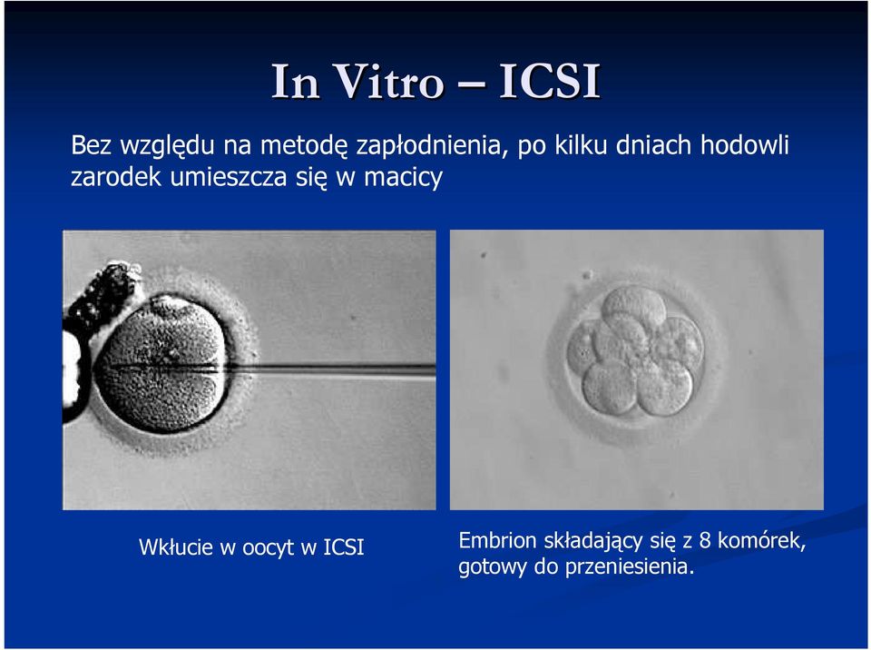 umieszcza się w macicy Wkłucie w oocyt w ICSI