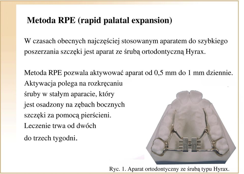 Metoda RPE pozwala aktywować aparat od 0,5 mm do 1 mm dziennie.