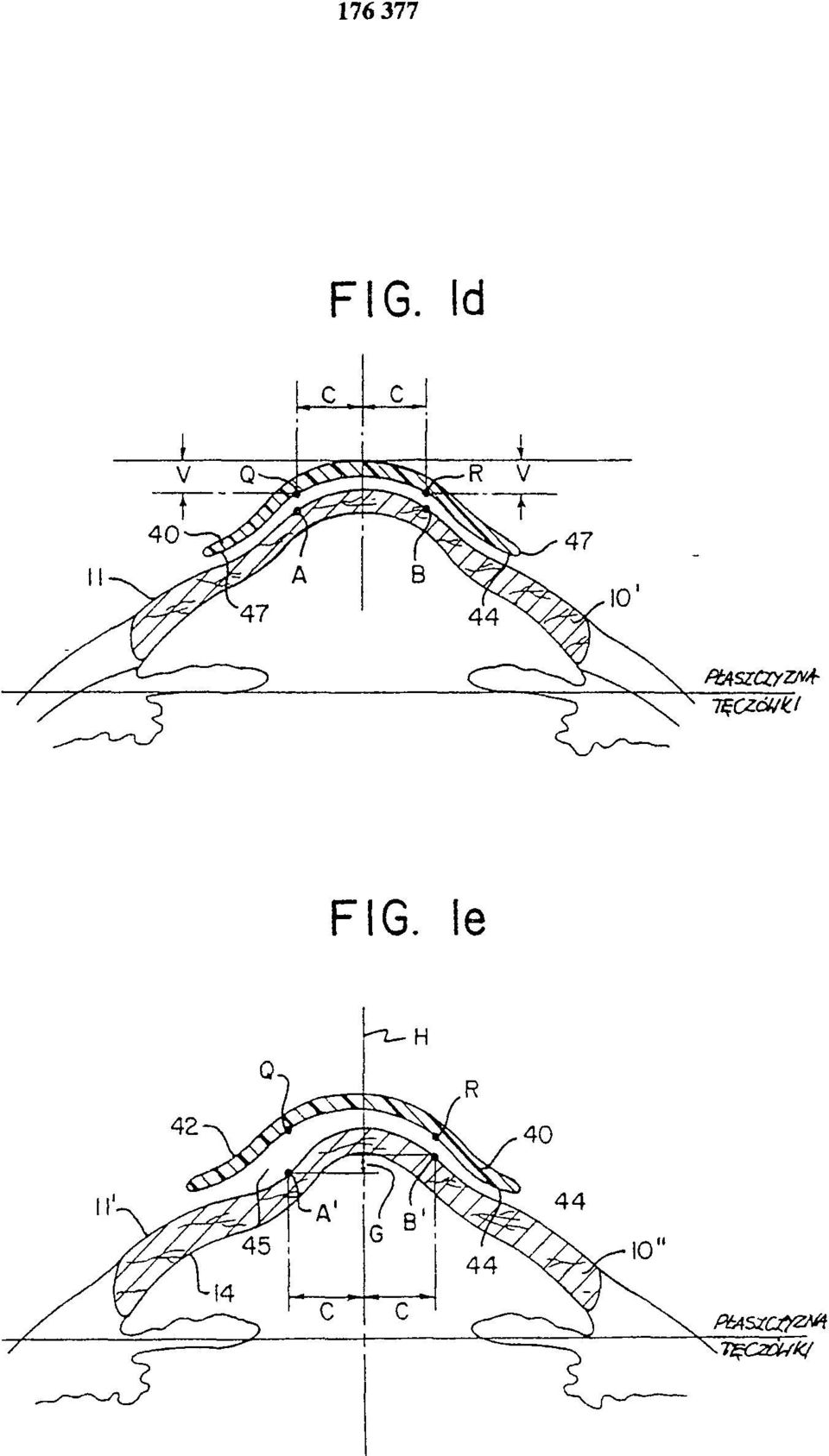 FIG. 1e