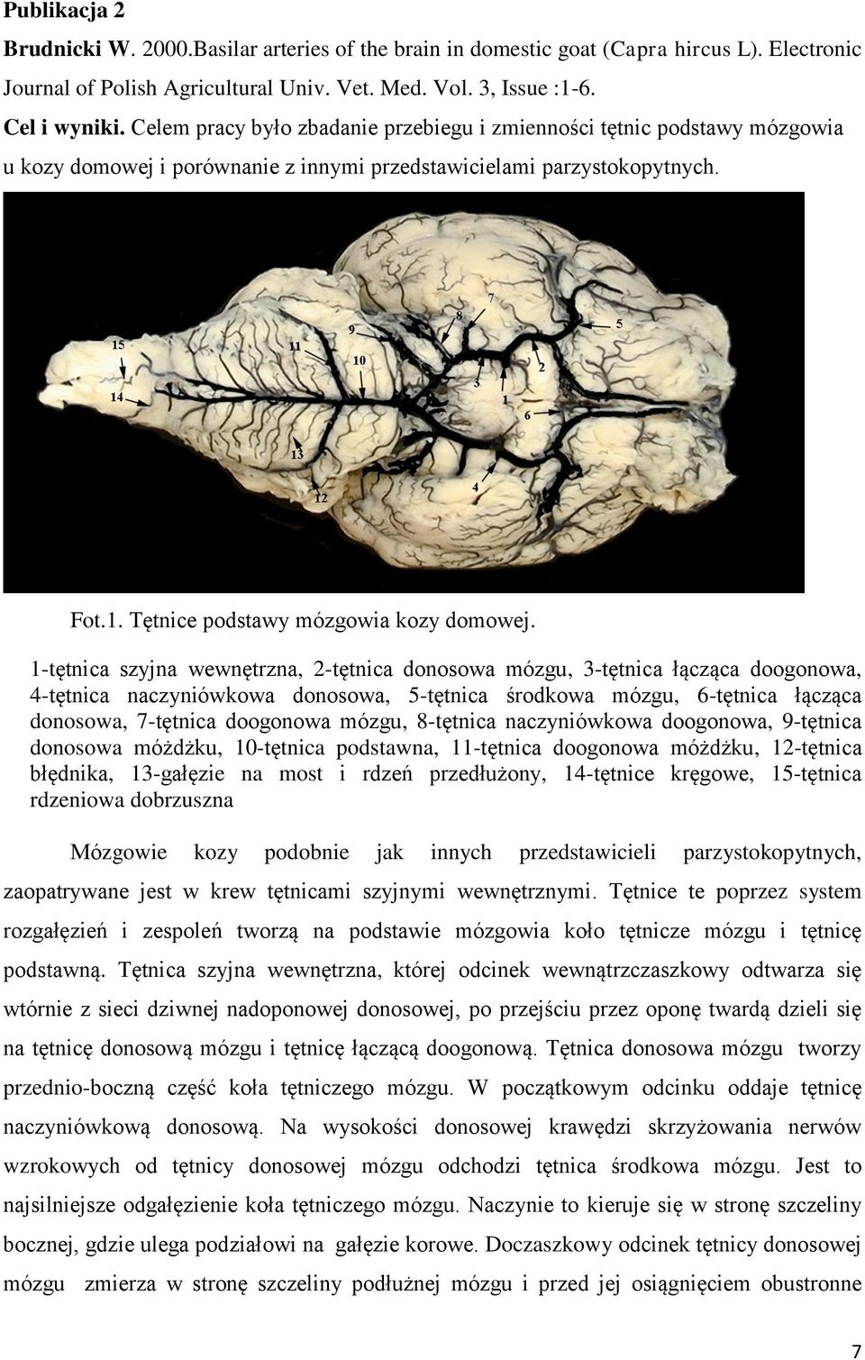 1-tętnica szyjna wewnętrzna, 2-tętnica donosowa mózgu, 3-tętnica łącząca doogonowa, 4-tętnica naczyniówkowa donosowa, 5-tętnica środkowa mózgu, 6-tętnica łącząca donosowa, 7-tętnica doogonowa mózgu,