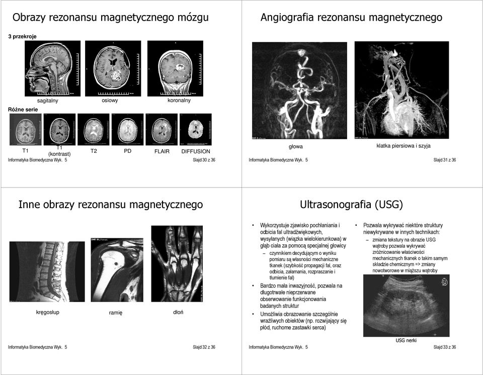 5 Slajd 31 z 36 Inne obrazy rezonansu magnetycznego Ultrasonografia (USG) kręgosłup ramię dłoń Wykorzystuje zjawisko pochłaniania i odbicia fal ultradźwiękowych, wysyłanych (wiązka wielokierunkowa) w