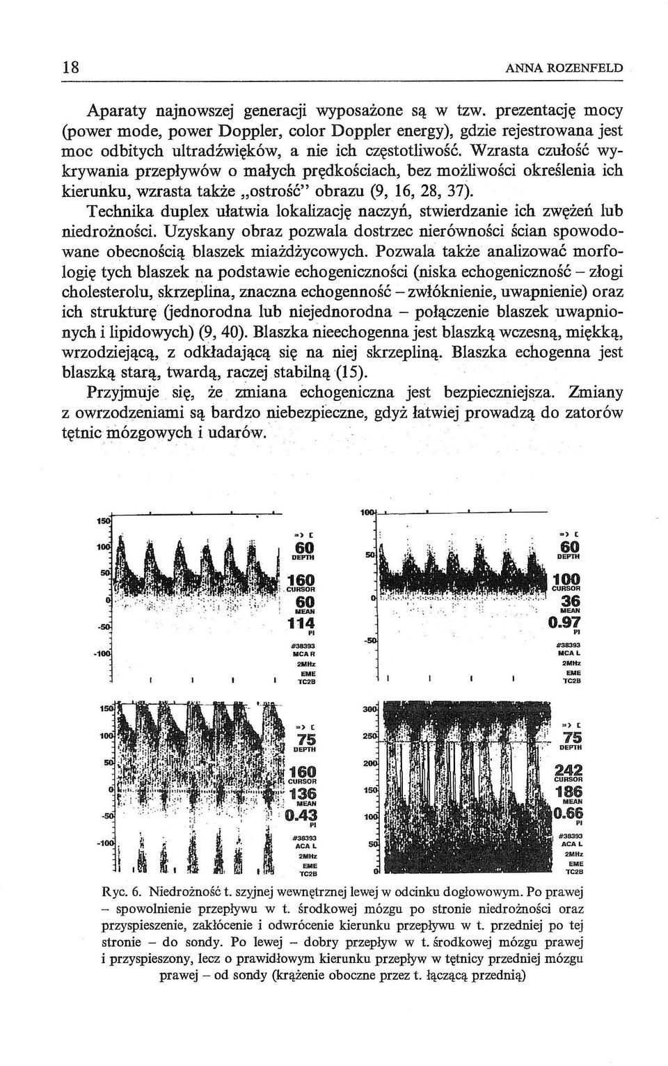 Wzrasta czułość wykrywania przepływów o małych prędkościach, bez możliwości określenia ich kierunku, wzrasta także "ostrość" obrazu (9, 16, 28, 37).