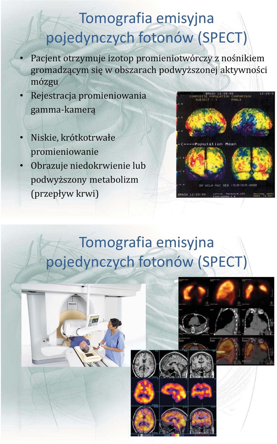 Rejestracja promieniowania gamma-kamerą Niskie, krótkotrwałe promieniowanie Obrazuje