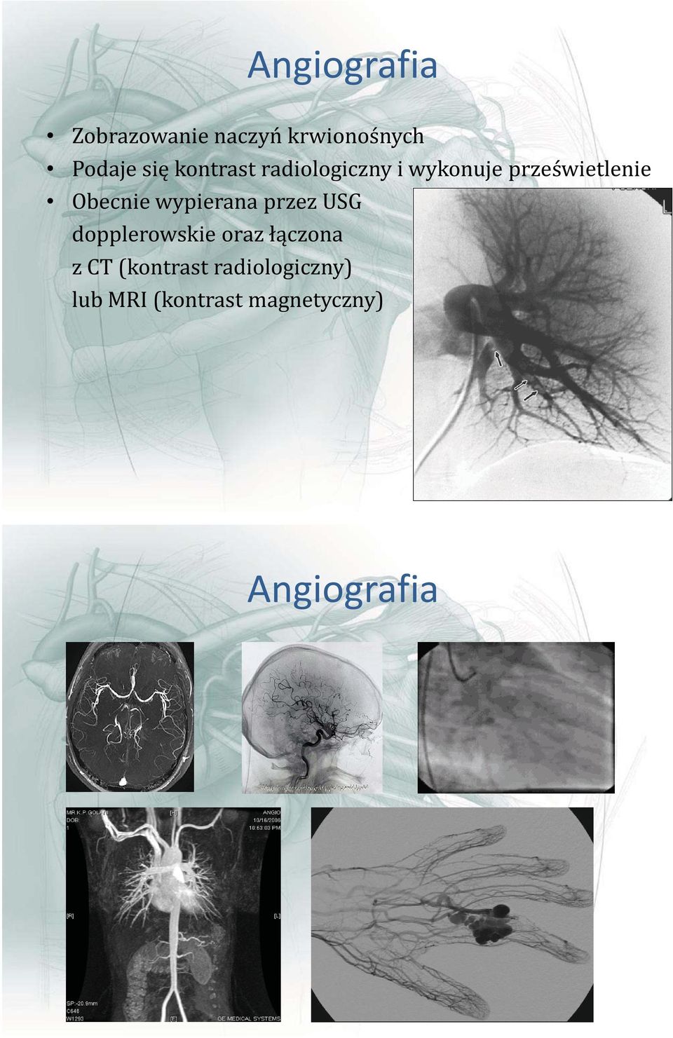 wypierana przez USG dopplerowskie oraz łączona z CT