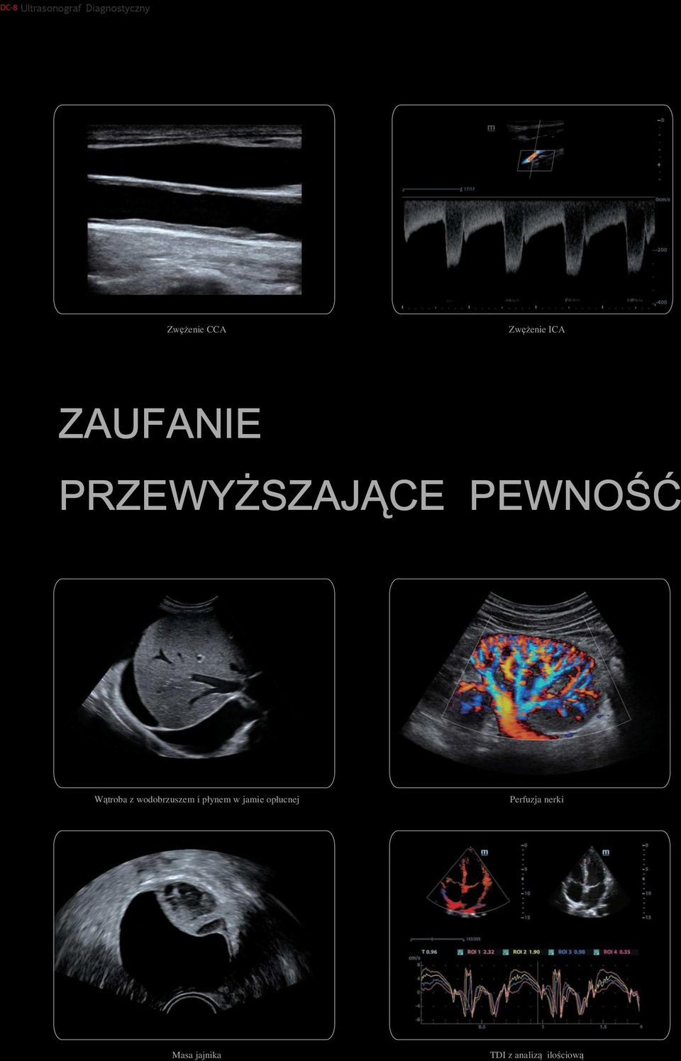 wodobrzuszem i płynem w jamie opłucnej