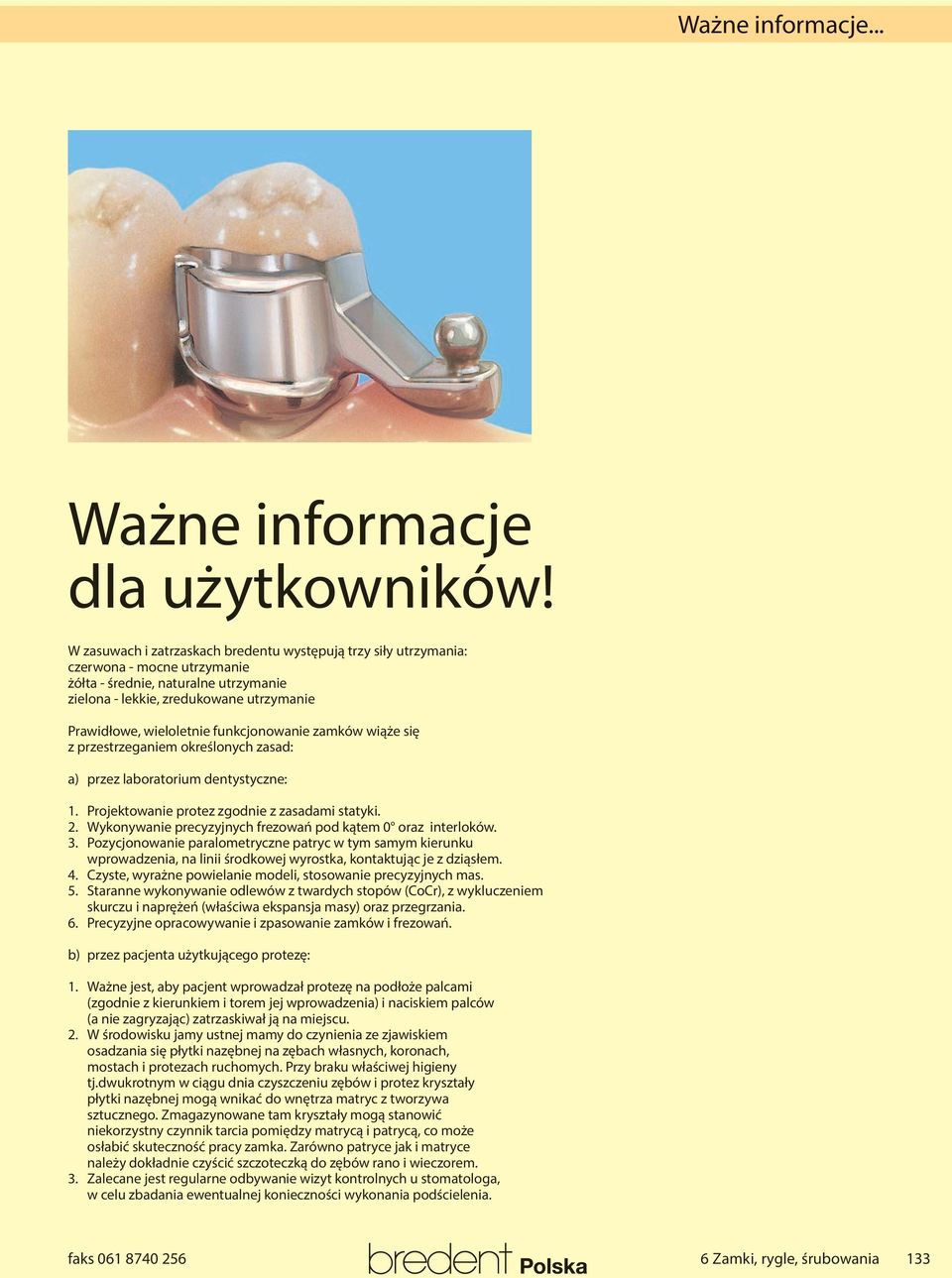 funkcjonowanie zamków wiąże się z przestrzeganiem określonych zasad: a) przez laboratorium dentystyczne:. Projektowanie protez zgodnie z zasadami statyki.