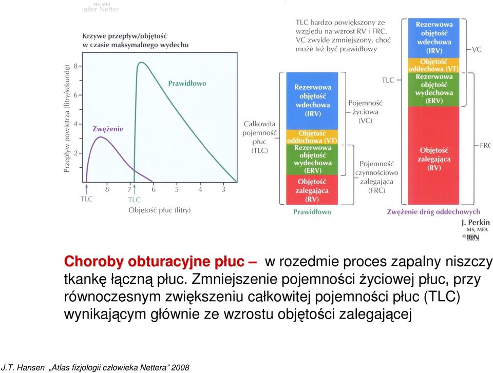 Zmniejszenie pojemności Ŝyciowej płuc, przy równoczesnym zwiększeniu