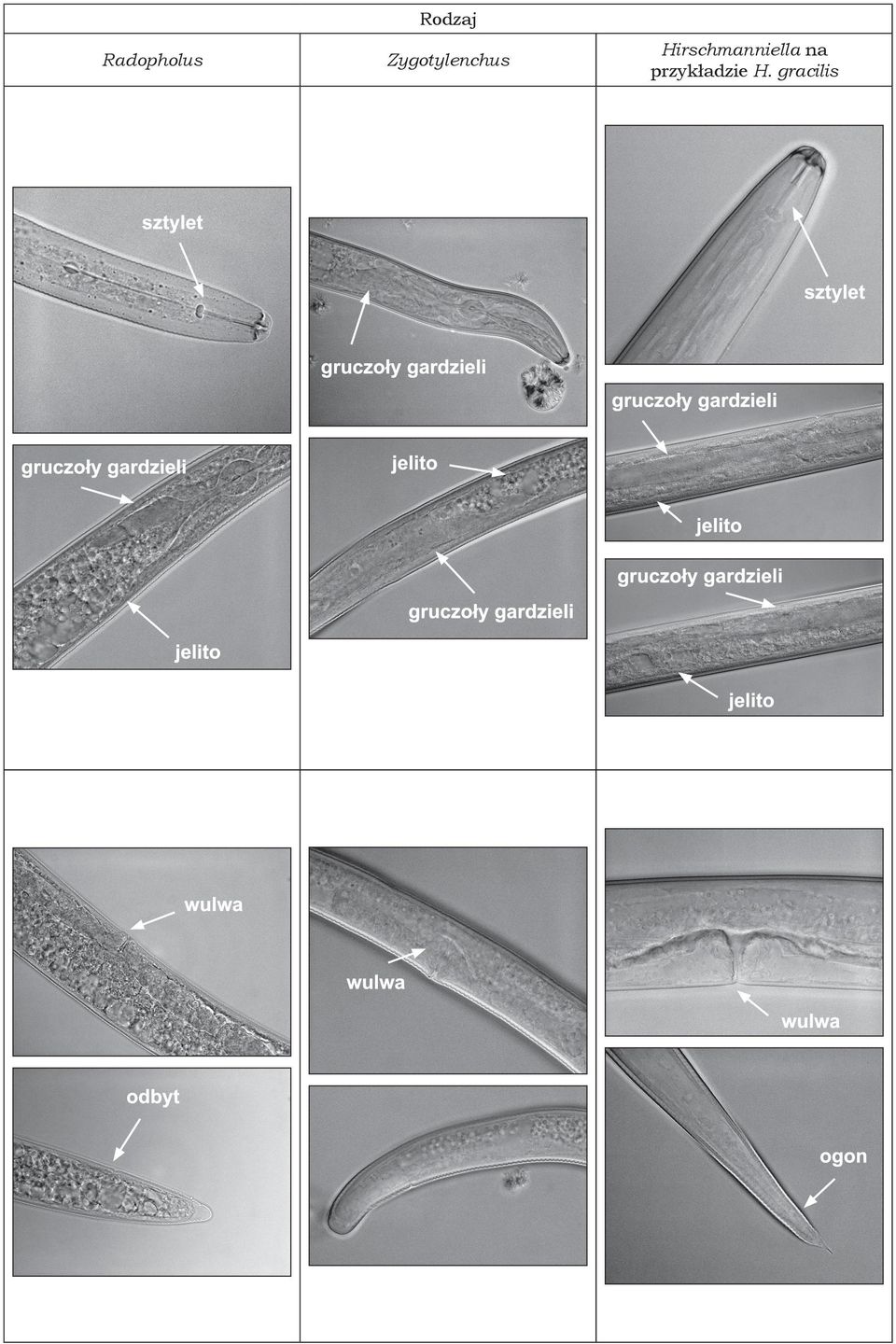 Hirschmanniella na