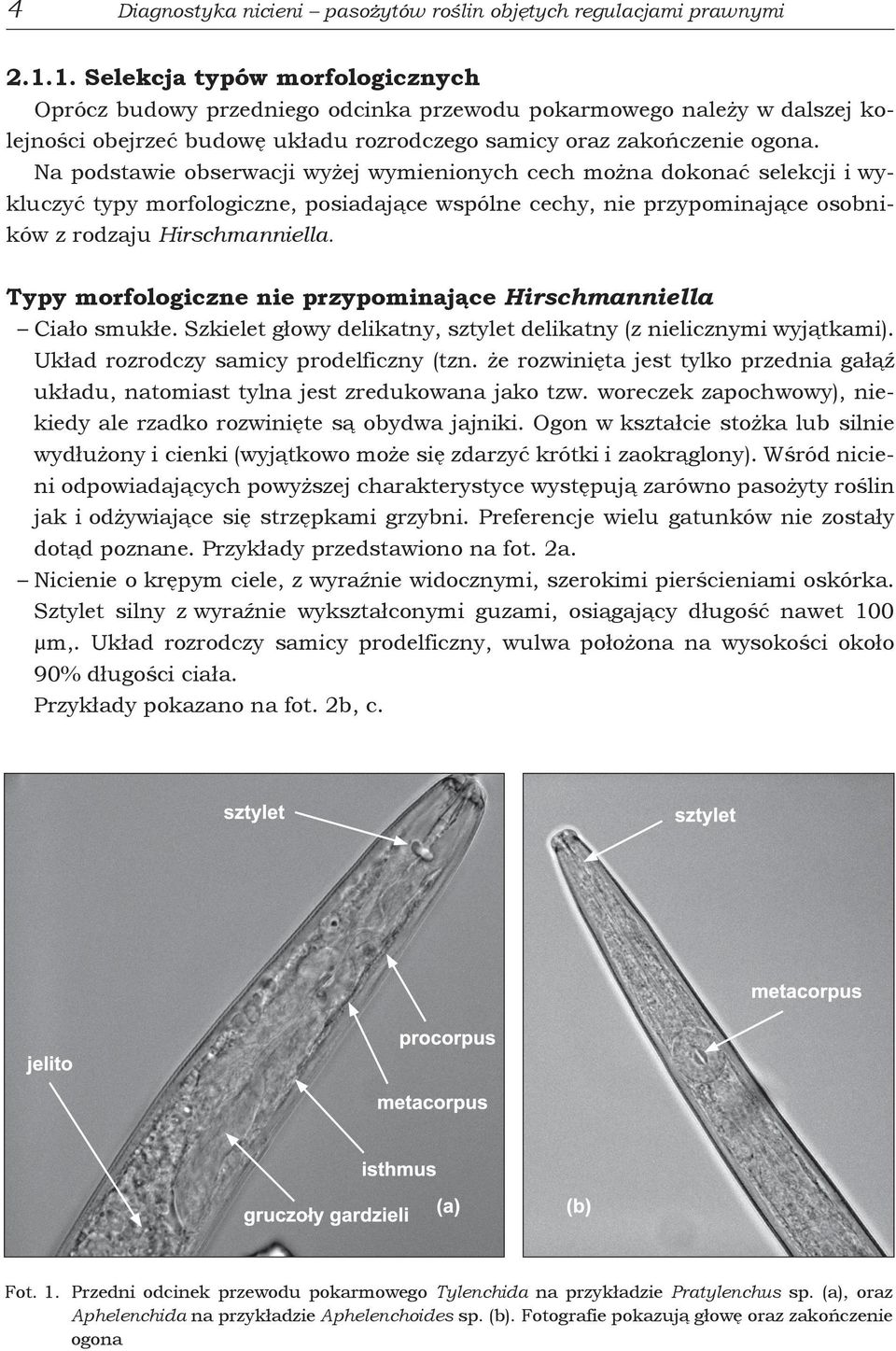 Na podstawie obserwacji wyżej wymienionych cech można dokonać selekcji i wykluczyć typy morfologiczne, posiadające wspólne cechy, nie przypominające osobników z rodzaju Hirschmanniella.