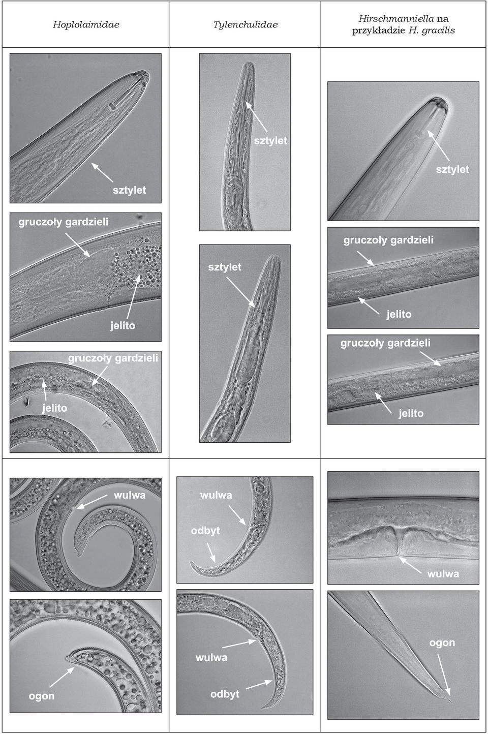 Hirschmanniella