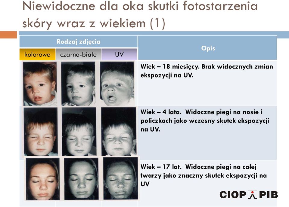 Brak widocznych zmian ekspozycji na UV. Wiek 4 lata.