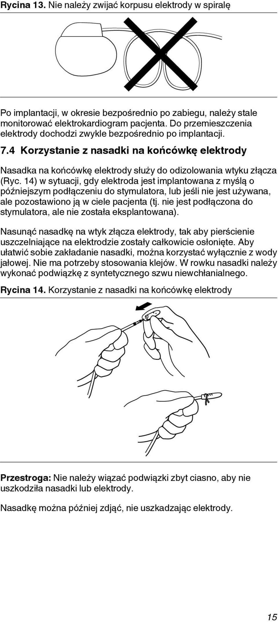 14) w sytuacji, gdy elektroda jest implantowana z myślą o późniejszym podłączeniu do stymulatora, lub jeśli nie jest używana, ale pozostawiono ją w ciele pacjenta (tj.