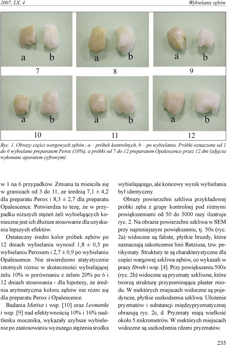 Zmiana ta mieściła się w granicach od do, ze średnią 7,1 ±, dla preparatu Perox i, ±,7 dla preparatu Opalescence.